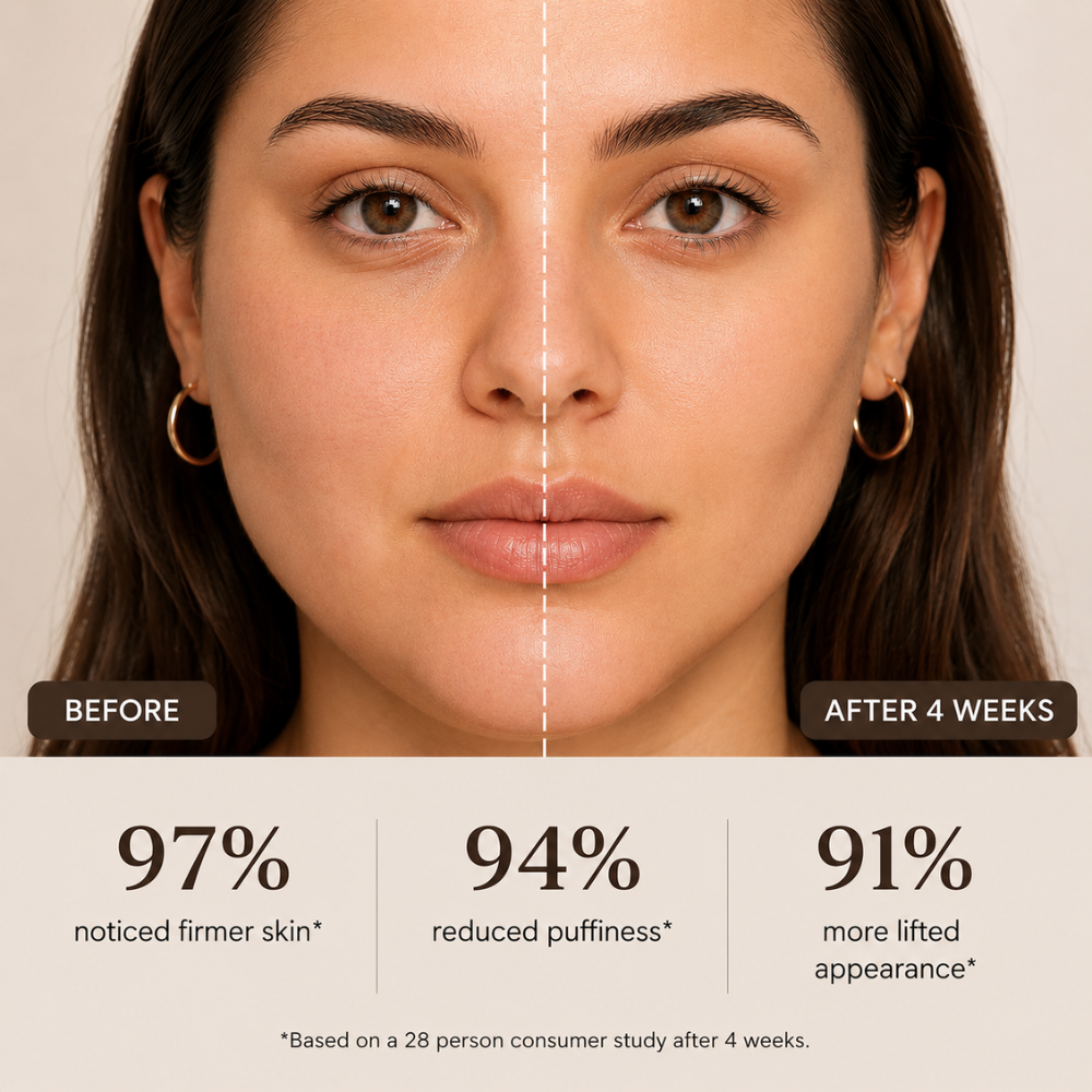 Beautefy SculptLift™