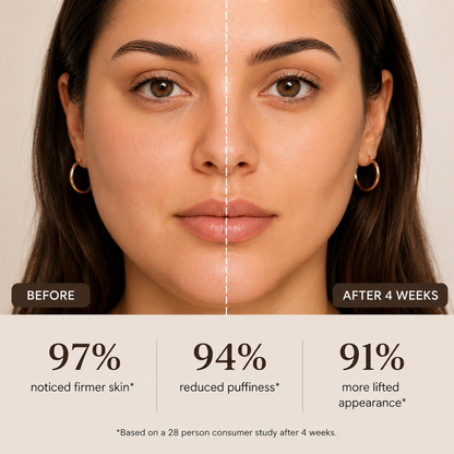 Beautefy SculptLift™