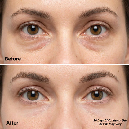 Collagen Hydrogel Eye Patches (60 count)