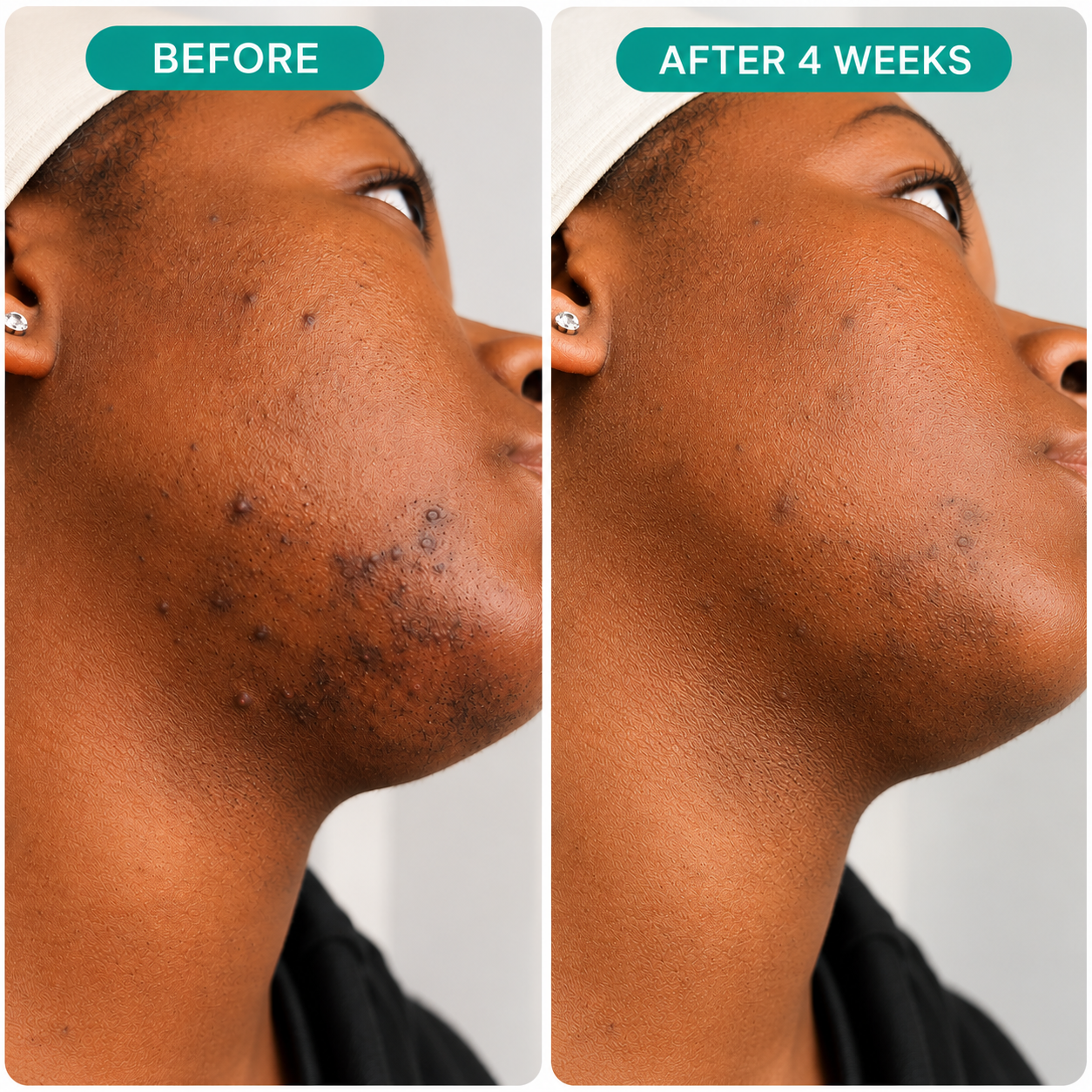 DreamSkin™ Collagen Face Mask
